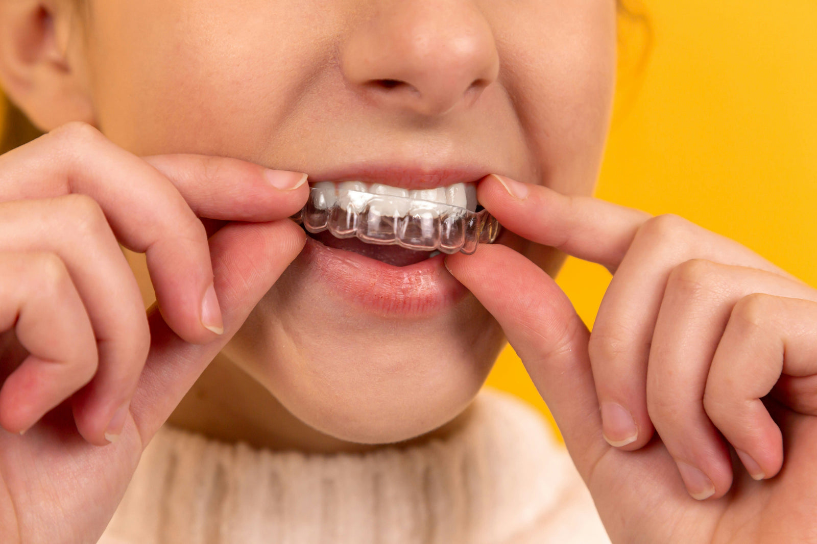 Invisalign®
